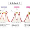 年代別に変わる冬の保湿ケア：20代・30代・40代以上のアプローチ