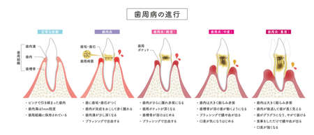 年代別に変わる冬の保湿ケア：20代・30代・40代以上のアプローチ